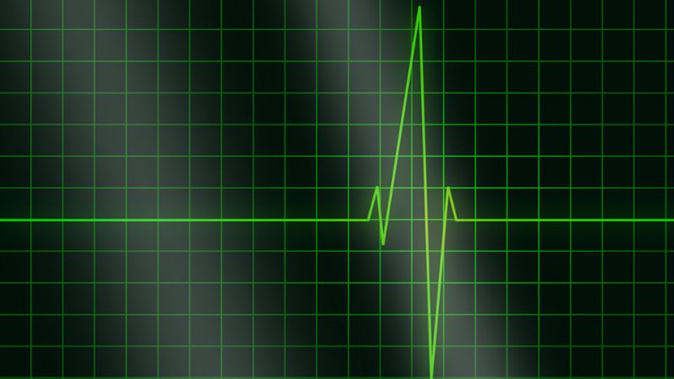 EKG-Diagramm: Heutzutage kann man seine Gesundheit mobil überwachen
