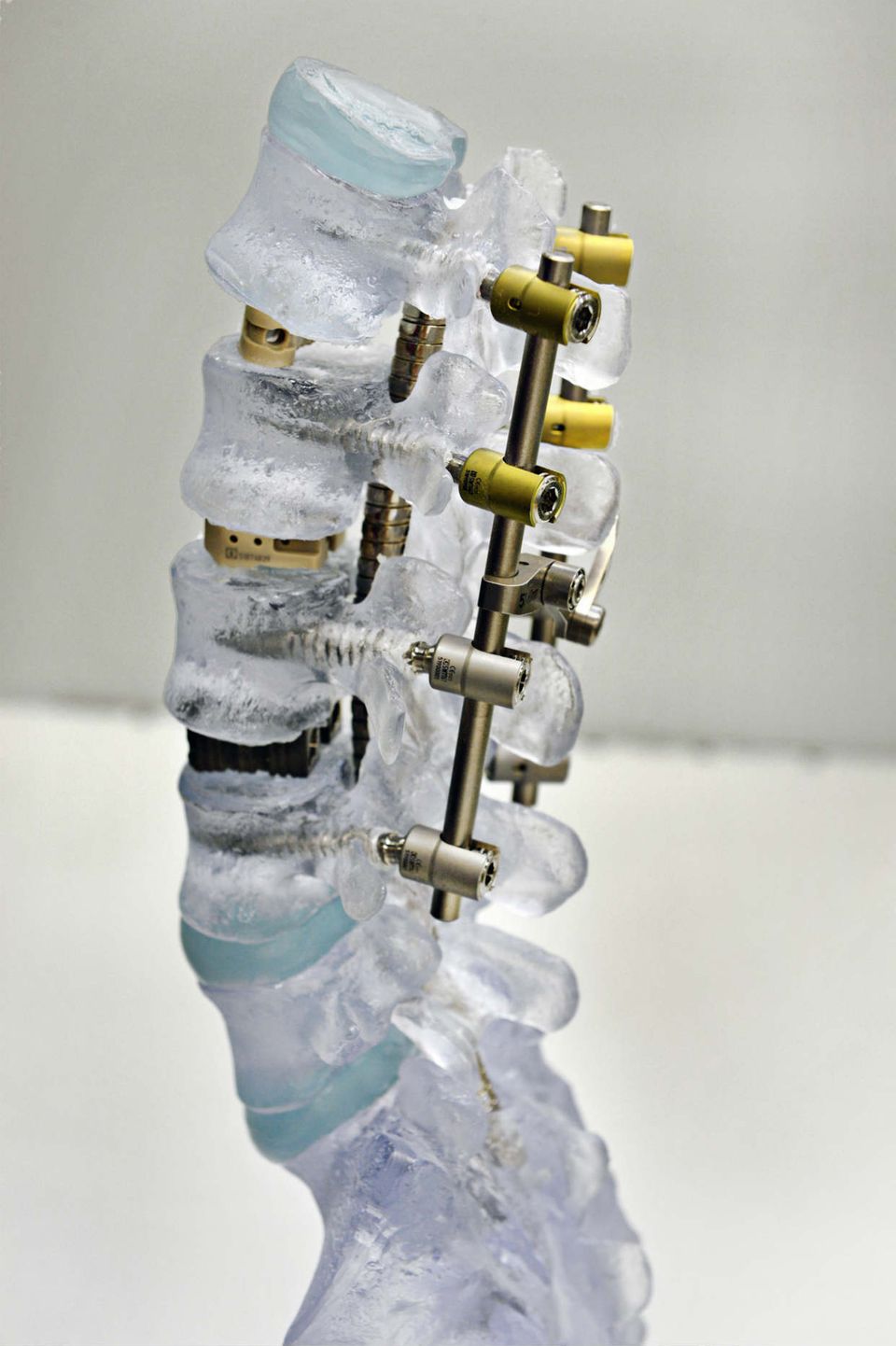 Implantate von Kopf bis Fuß gibt es im Besucherzentrum von Aesculap, hier ein Implantat für die Wirbelsäule
