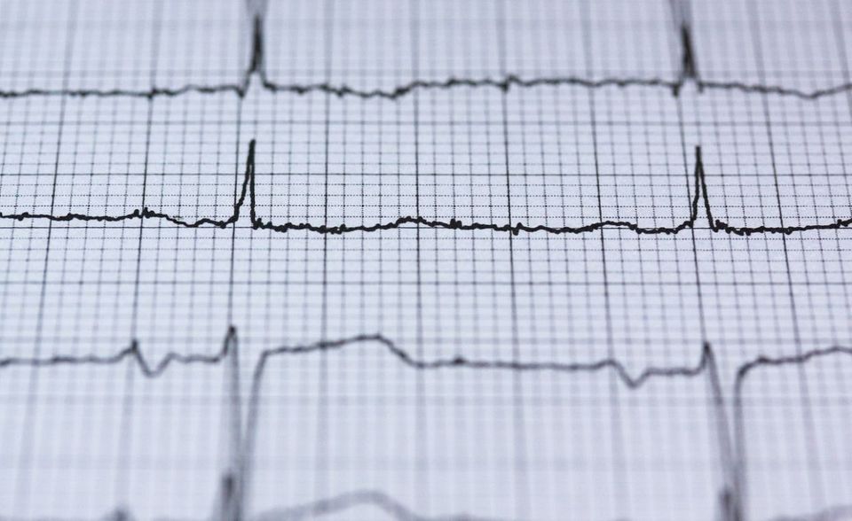 Erkrankungen des Herzens und des Gefäßsystems sind für etwa sieben Prozent aller Fälle von Berufs- und Erwerbsunfähigkeit verantwortlich. Das war ein Prozentpunkt weniger als im Vorjahr, wie der GDV mitteilte. In diese Kategorie fallen Betroffene, die etwa nach einem Herzinfarkt oder einer Bypass-Operation nicht mehr voll berufsfähig sind.