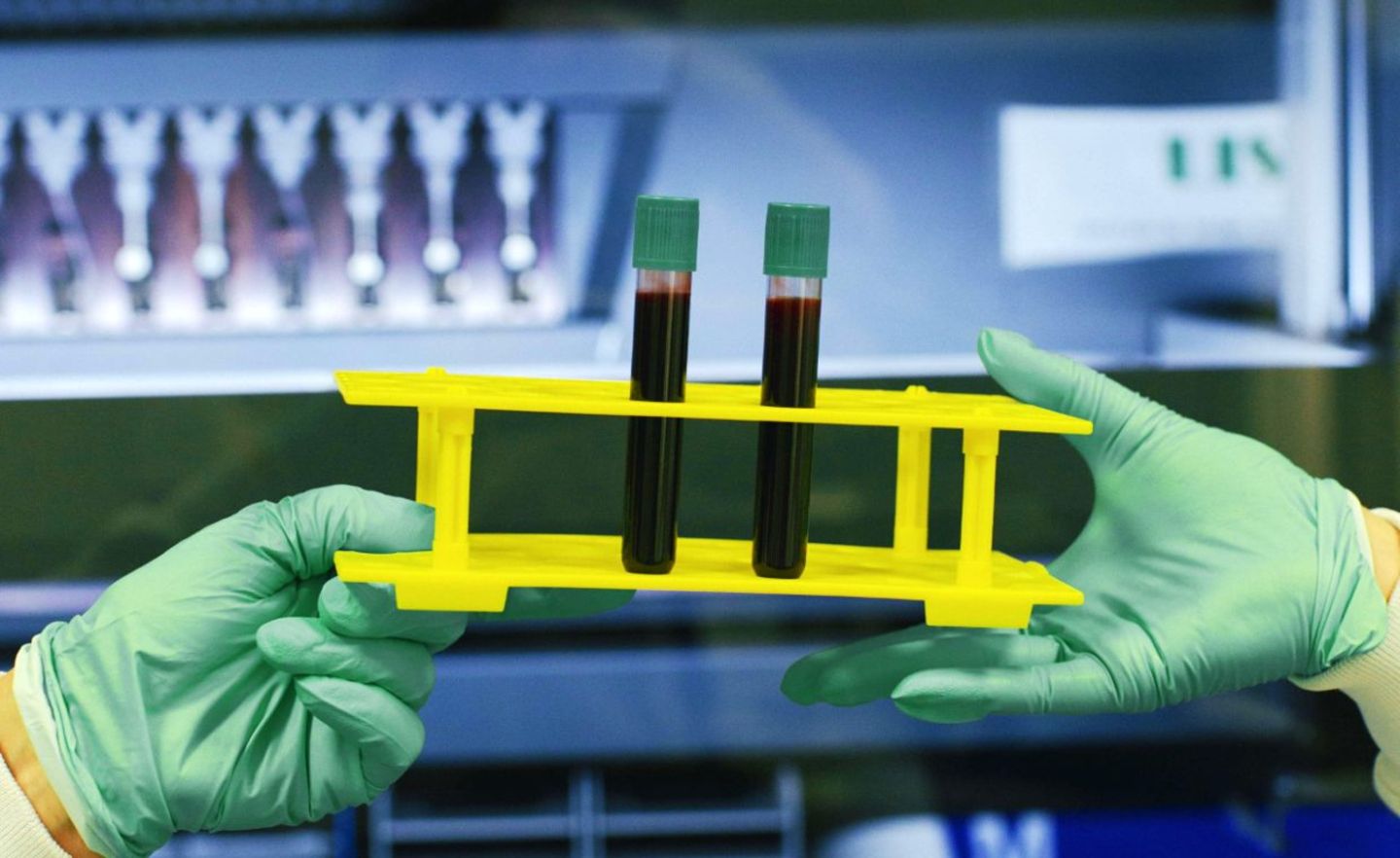 Das wird vielleicht mal groß: Das Pharma-Start-up Biontech könnte zum Weltkonzern aufsteigen