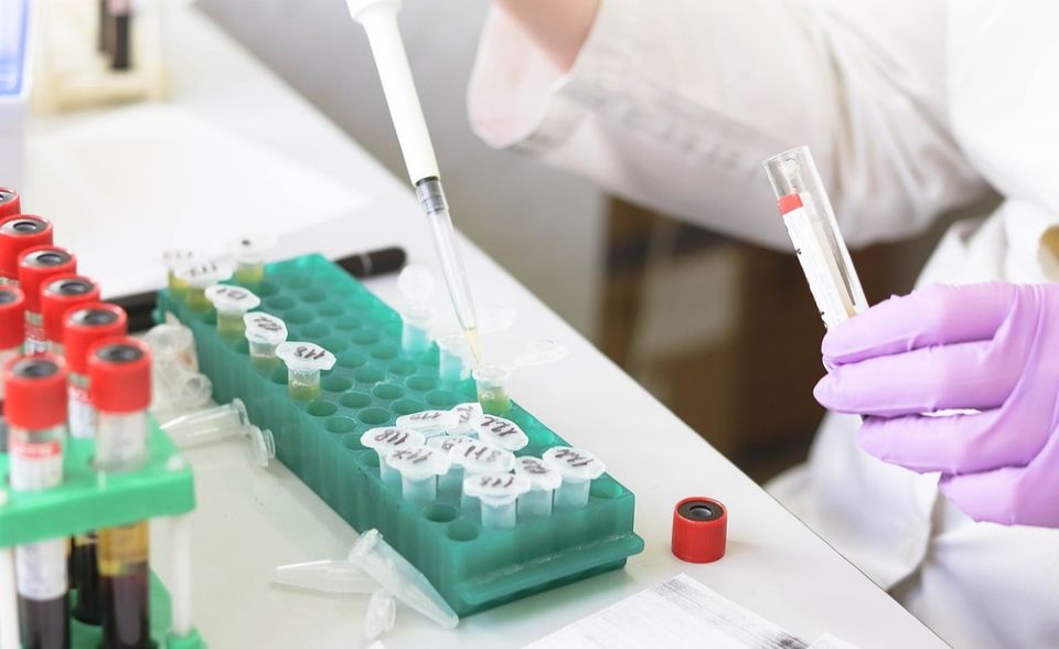 Die Angst vor dem Coronavirus wird immer wieder von der Sorge begleitet, bei dem eigenen Husten oder Schnupfen handle es sich um eine Infektion mit den Erregern. Das Biotech-Unternehmen Qiagen hat mittlerweile mehrere Tests entwickelt, die das Virus Sars-CoV-2 nachweisen sollen. Auch an den Aktienmärkten machte sich das bemerkbar: Im Januar war die Qiagen-Aktie mit einem Anstieg von zwischenzeitlich sieben Prozent im Aufwind. Dem Kurssturz Ende Februar konnte sich der Titel zwar nicht ziehen, mittlerweile geht es aber steil bergauf.
