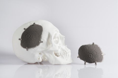 3D-Druck ist unter anderem in der Medizintechnik gefragt. Eos liefert das nötige Gerät