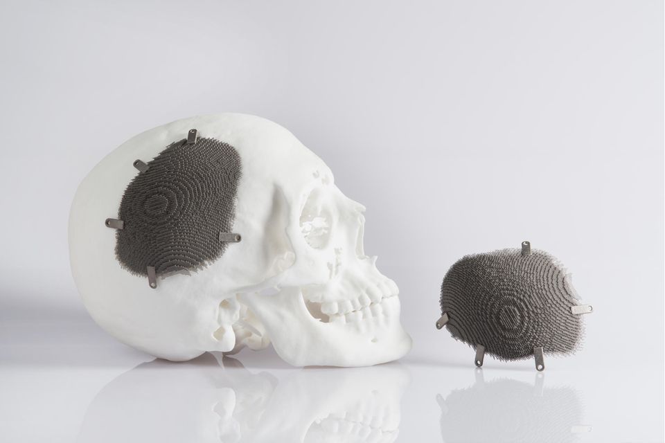 3D-Druck ist unter anderem in der Medizintechnik gefragt. Eos liefert das nötige Gerät