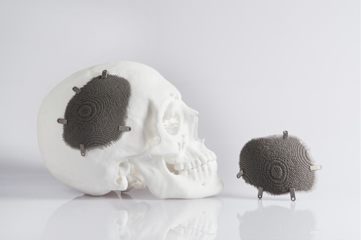 3D-Druck ist unter anderem in der Medizintechnik gefragt. Eos liefert das nötige Gerät