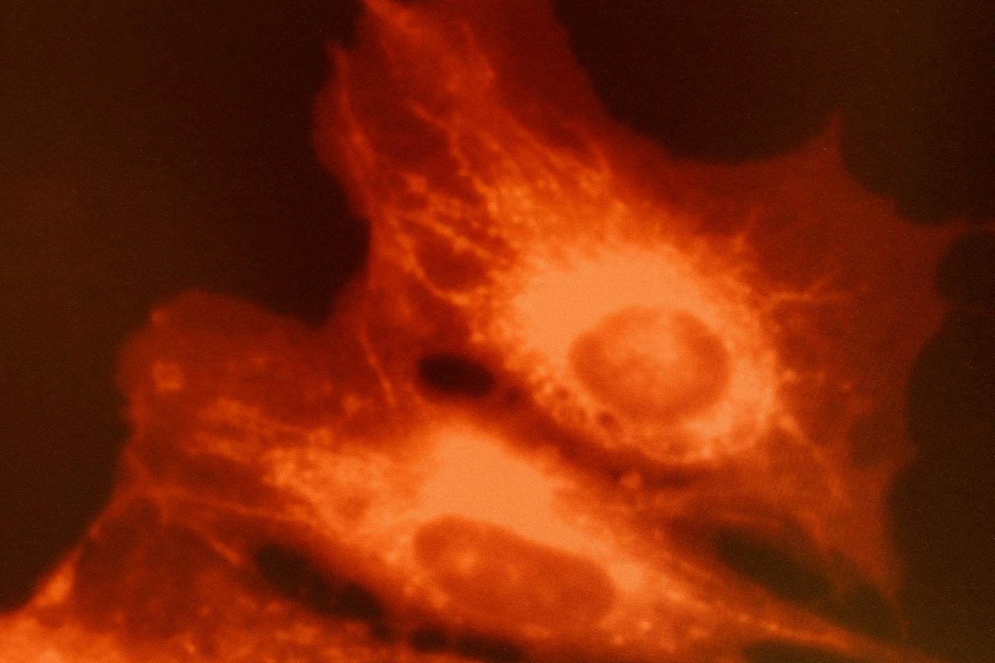 Mitochondrien umschwirren unterm Mikroskop Körperzellen. Durch Transplantation dieser Energielieferanten lassen sich Alterungsprozesse womöglich verlangsamen 