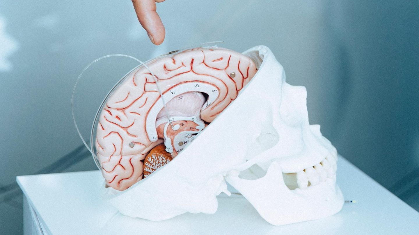 Neurotechnologie-Weltweit-t-fteln-Start-ups-an-Hirnimplantaten-auch-diese-Freiburger-Firma-Capital-